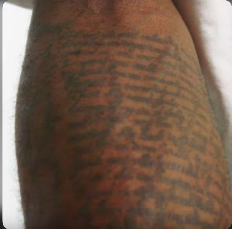 Burnaboy’s Psalm 38 Tattoo